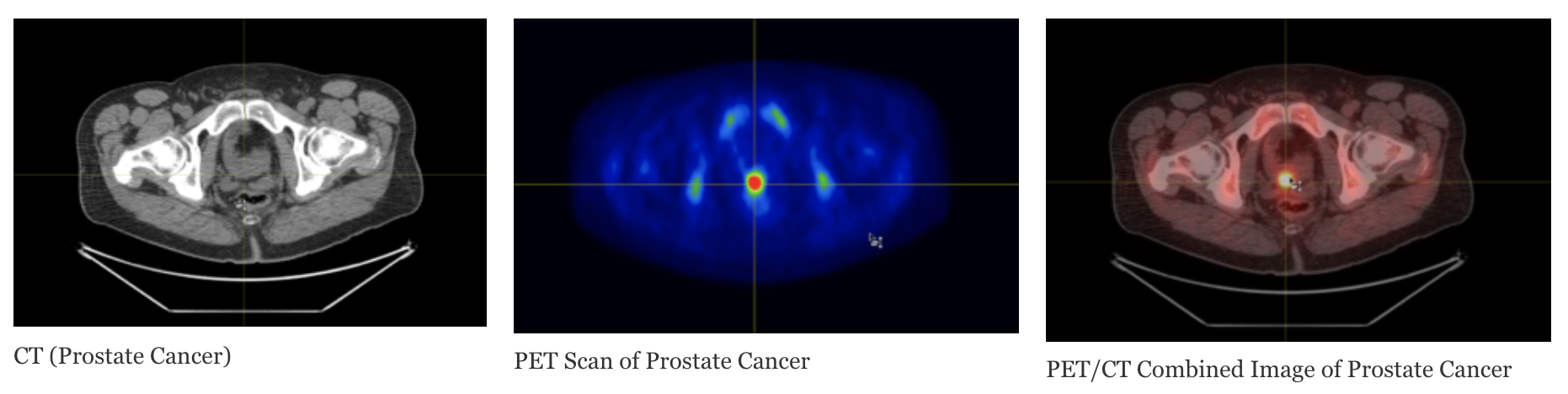 Examples of scans